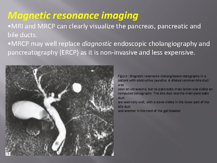 Magnetic resonance imaging • MRI and MRCP can clearly visualize the pancreas, pancreatic and