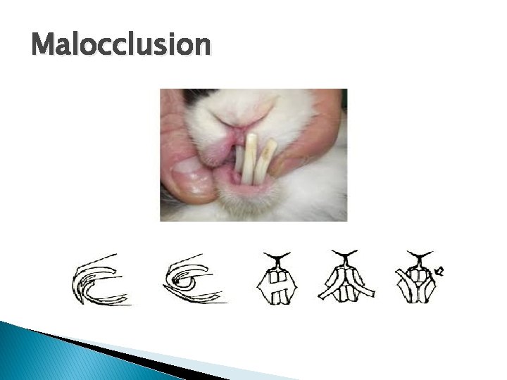 Malocclusion 
