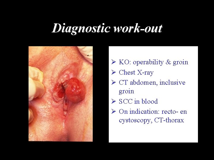 Diagnostic work-out Ø KO: operability & groin Ø Chest X-ray Ø CT abdomen, inclusive