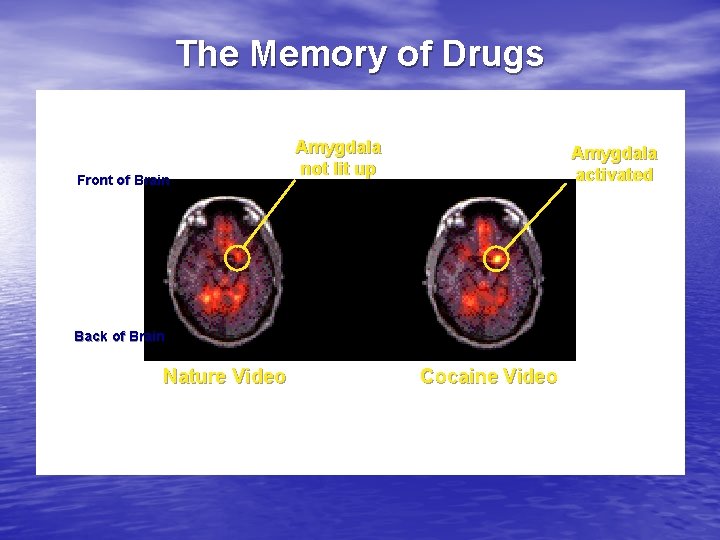 The Memory of Drugs Front of Brain Amygdala not lit up Amygdala activated Back