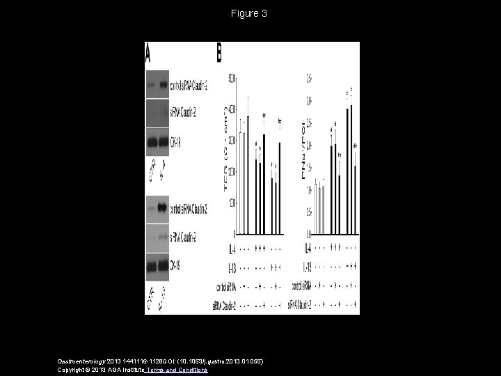 Figure 3 Gastroenterology 2013 1441116 -1128 DOI: (10. 1053/j. gastro. 2013. 01. 055) Copyright