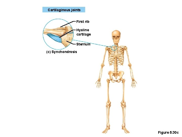 Cartilaginous joints First rib Hyaline cartilage Sternum (c) Synchondrosis Figure 5. 30 c 
