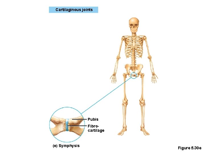 Cartilaginous joints Pubis Fibrocartilage (e) Symphysis Figure 5. 30 e 
