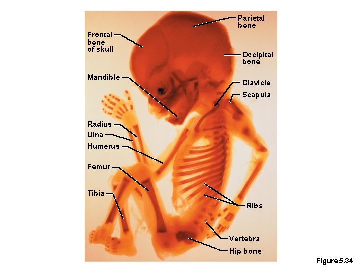 Parietal bone Frontal bone of skull Mandible Occipital bone Clavicle Scapula Radius Ulna Humerus