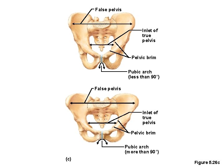 False pelvis Inlet of true pelvis Pelvic brim Pubic arch (less than 90°) False