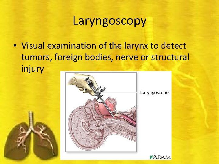 Laryngoscopy • Visual examination of the larynx to detect tumors, foreign bodies, nerve or