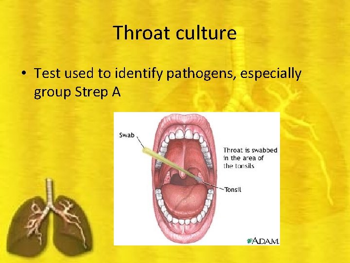 Throat culture • Test used to identify pathogens, especially group Strep A 