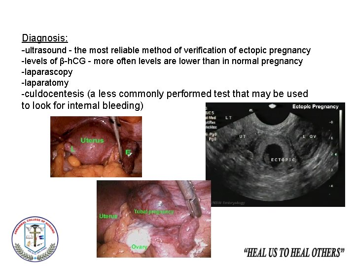Diagnosis: -ultrasound - the most reliable method of verification of ectopic pregnancy -levels of