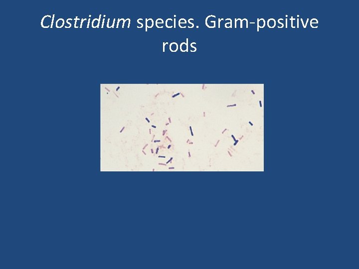 Clostridium species. Gram-positive rods 