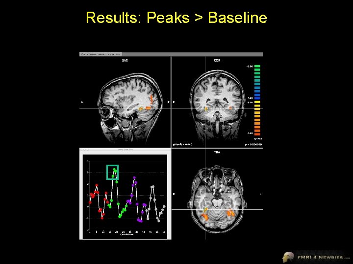 Results: Peaks > Baseline 