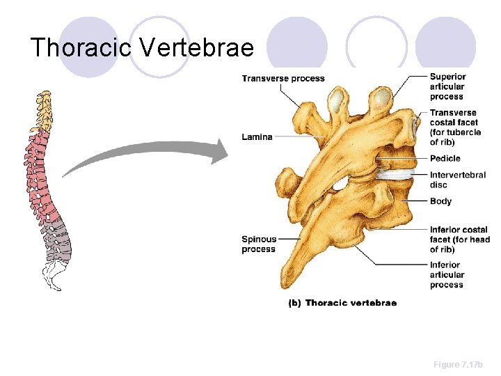Thoracic Vertebrae Figure 7. 17 b 