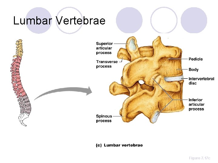 Lumbar Vertebrae Figure 7. 17 c 