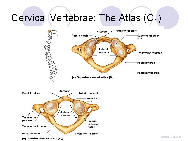 Cervical Vertebrae: The Atlas (C 1) Figure 7. 16 a, b 