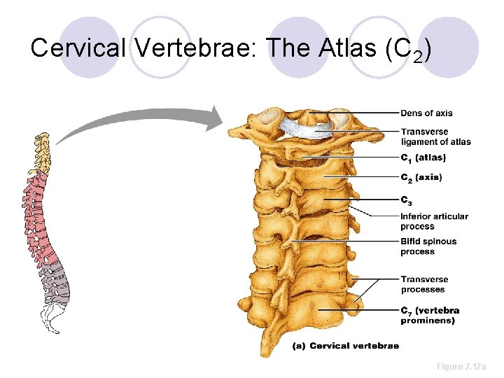 Cervical Vertebrae: The Atlas (C 2) Figure 7. 17 a 