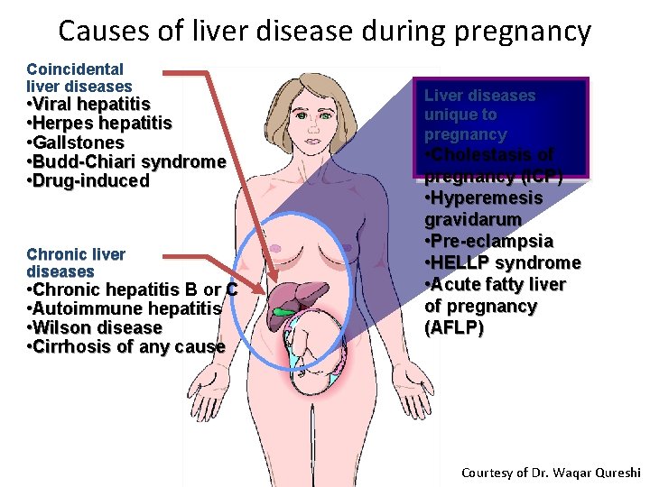 Causes of liver disease during pregnancy Coincidental liver diseases • Viral hepatitis • Herpes