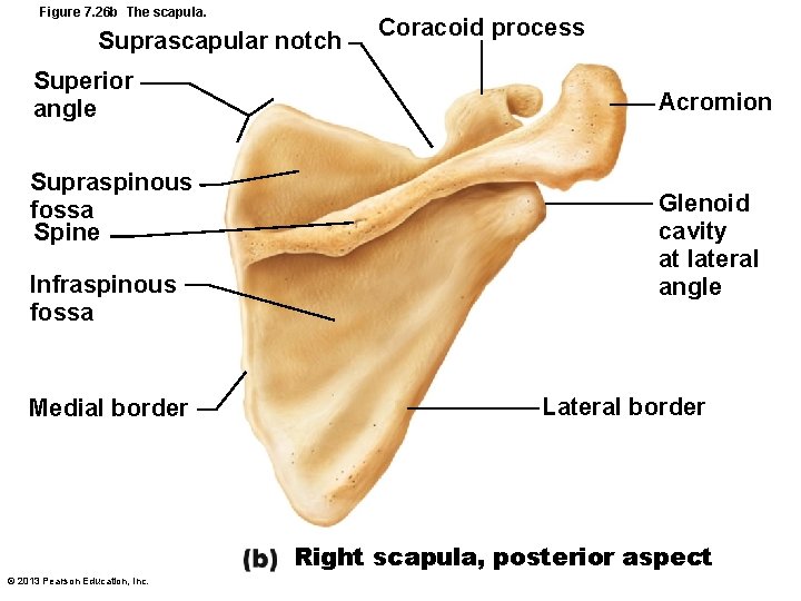 Figure 7. 26 b The scapula. Suprascapular notch Superior angle Supraspinous fossa Spine Infraspinous
