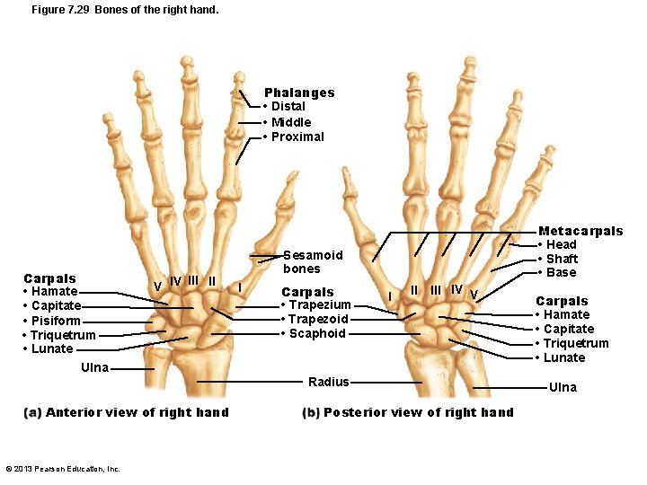Figure 7. 29 Bones of the right hand. Phalanges • Distal • Middle •