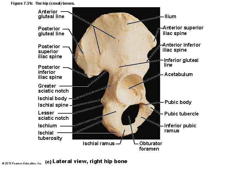 Figure 7. 31 c The hip (coxal) bones. Anterior gluteal line Ilium Posterior gluteal