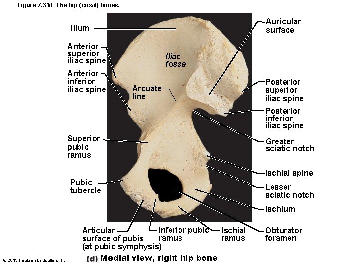 Figure 7. 31 d The hip (coxal) bones. Auricular surface Ilium Anterior superior iliac