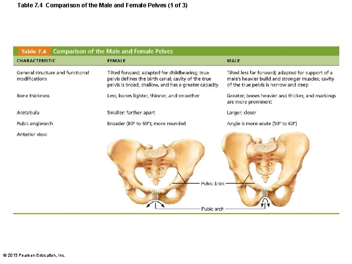 Table 7. 4 Comparison of the Male and Female Pelves (1 of 3) ©