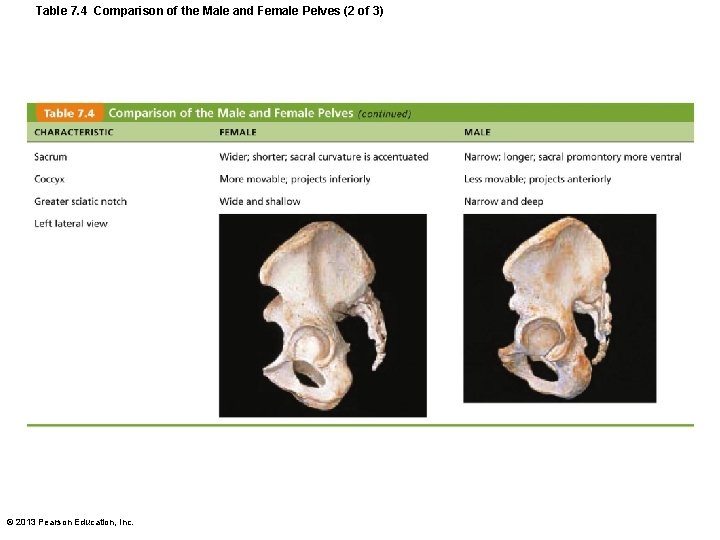 Table 7. 4 Comparison of the Male and Female Pelves (2 of 3) ©