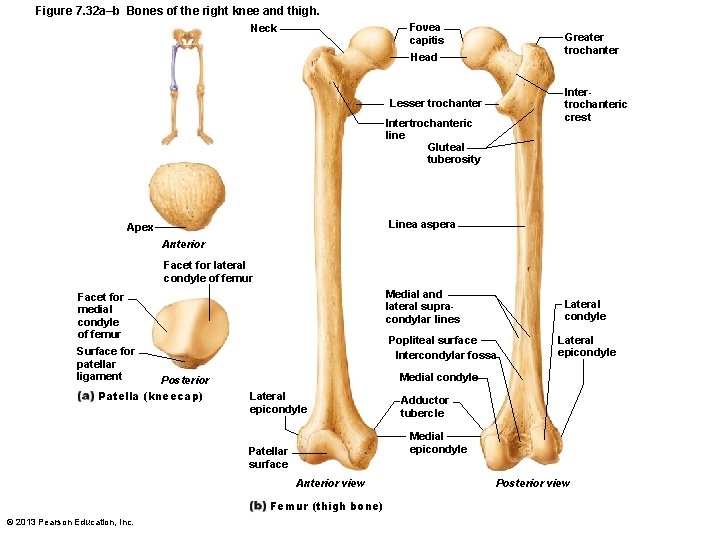 Figure 7. 32 a–b Bones of the right knee and thigh. Fovea capitis Neck