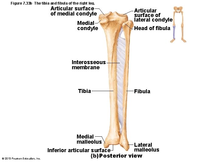 Figure 7. 33 b The tibia and fibula of the right leg. Articular surface