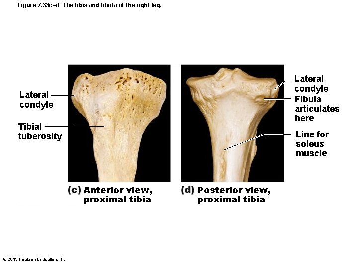 Figure 7. 33 c–d The tibia and fibula of the right leg. Lateral condyle
