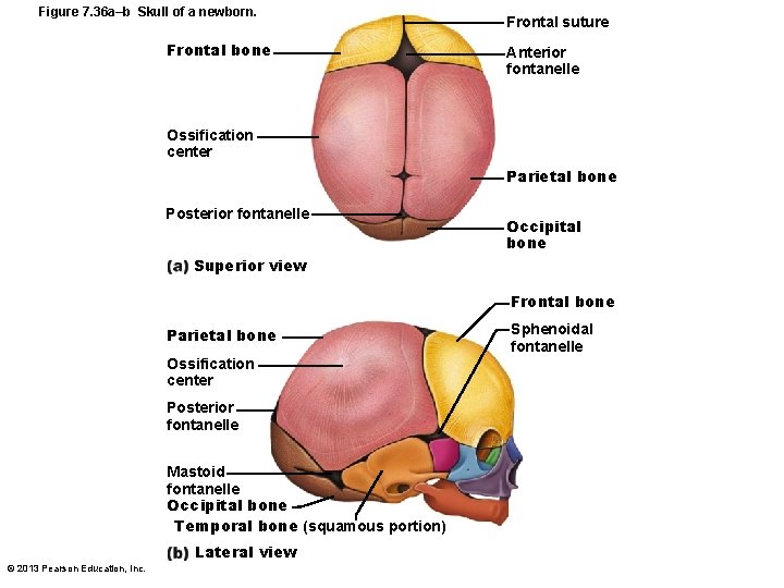 Figure 7. 36 a–b Skull of a newborn. Frontal bone Frontal suture Anterior fontanelle