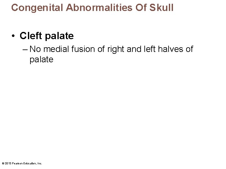 Congenital Abnormalities Of Skull • Cleft palate – No medial fusion of right and