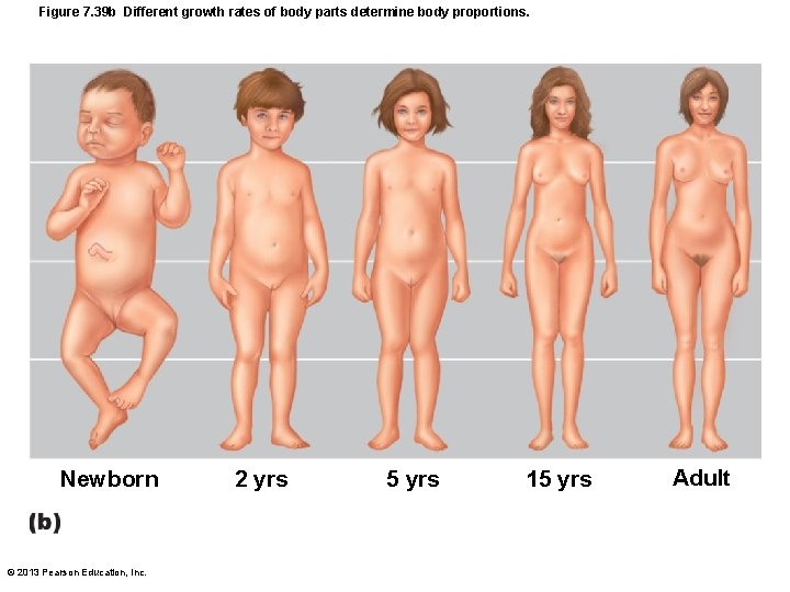 Figure 7. 39 b Different growth rates of body parts determine body proportions. Newborn