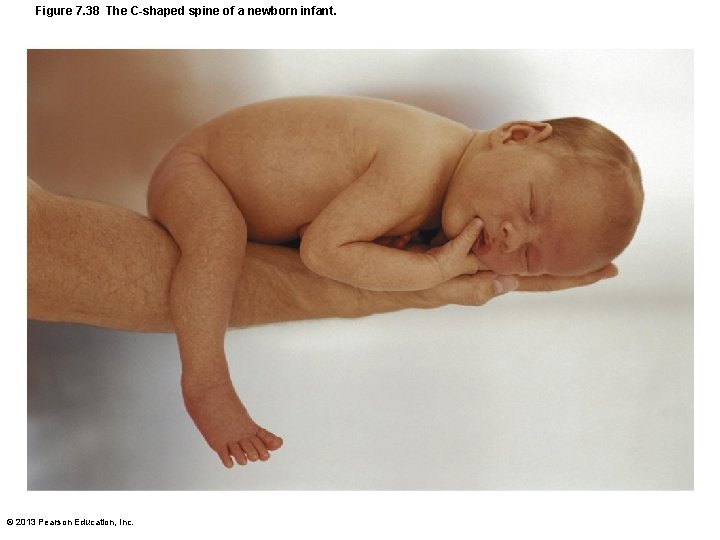 Figure 7. 38 The C-shaped spine of a newborn infant. © 2013 Pearson Education,