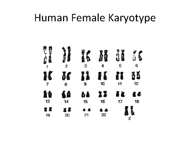Human Female Karyotype 