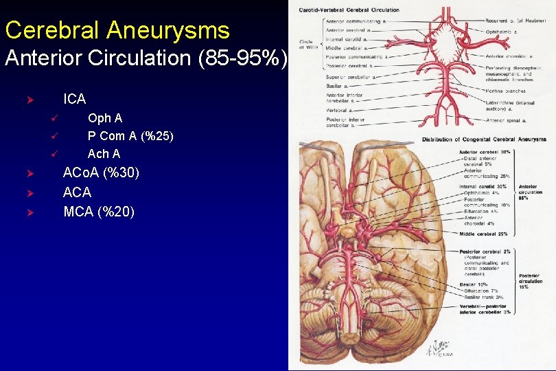 Cerebral Aneurysms Anterior Circulation (85 -95%) ICA Ø ü ü ü Ø Ø Ø