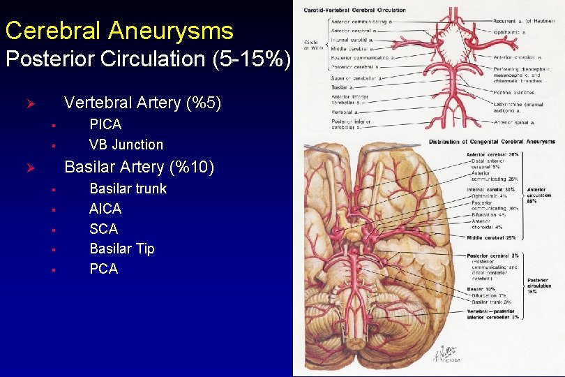 Cerebral Aneurysms Posterior Circulation (5 -15%) Vertebral Artery (%5) Ø § § PICA VB