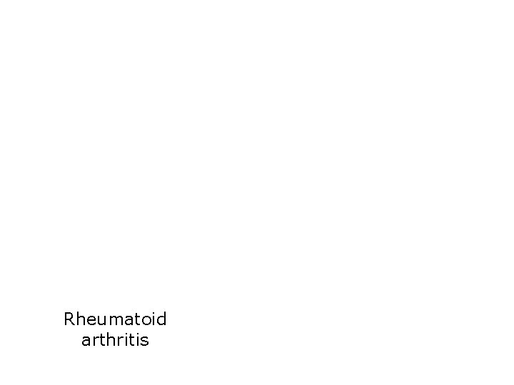 Rheumatoid arthritis 