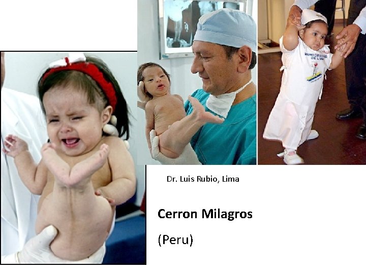 Dr. Luis Rubio, Lima Cerron Milagros (Peru) 