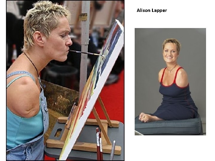 Alison Lapper 