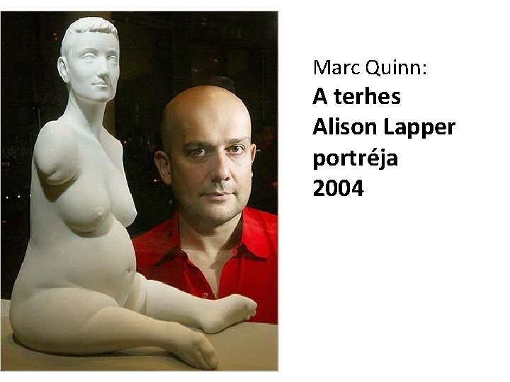 Marc Quinn: A terhes Alison Lapper portréja 2004 