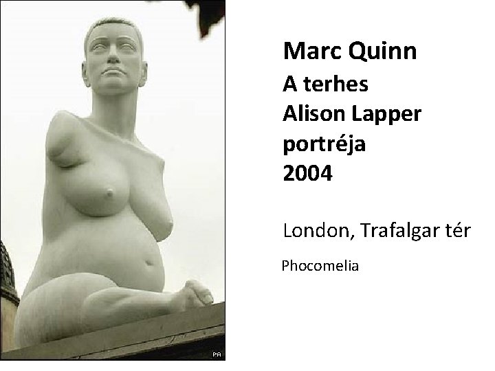 Marc Quinn A terhes Alison Lapper portréja 2004 London, Trafalgar tér Phocomelia 