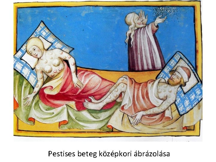Pestises beteg középkori ábrázolása 