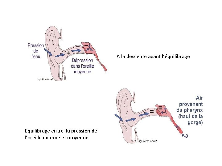 A la descente avant l’équilibrage Equilibrage entre la pression de l’oreille externe et moyenne