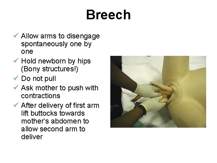 Breech ü Allow arms to disengage spontaneously one by one ü Hold newborn by