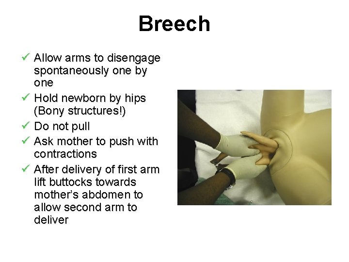 Breech ü Allow arms to disengage spontaneously one by one ü Hold newborn by