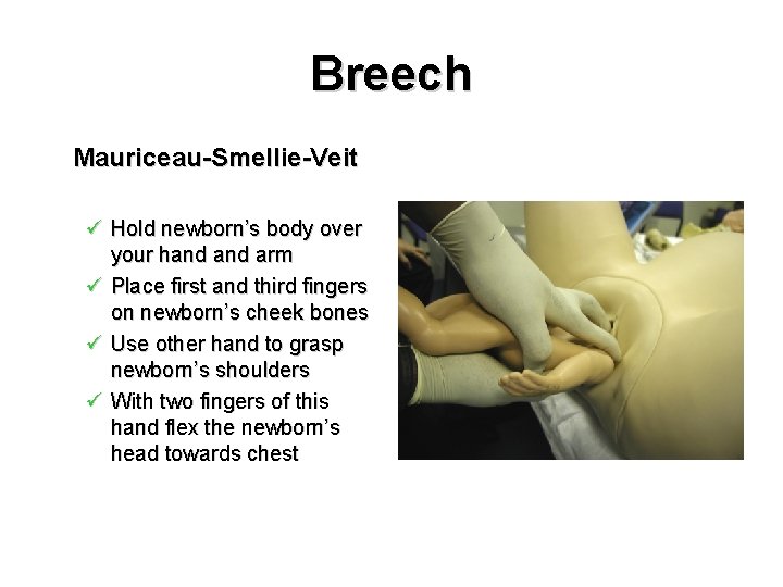 Breech Mauriceau-Smellie-Veit ü Hold newborn’s body over your hand arm ü Place first and