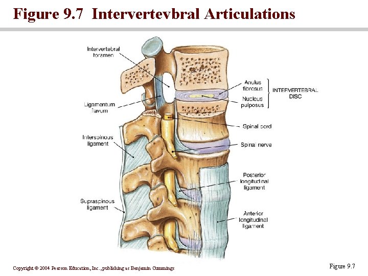 Figure 9. 7 Intervertevbral Articulations Copyright © 2004 Pearson Education, Inc. , publishing as