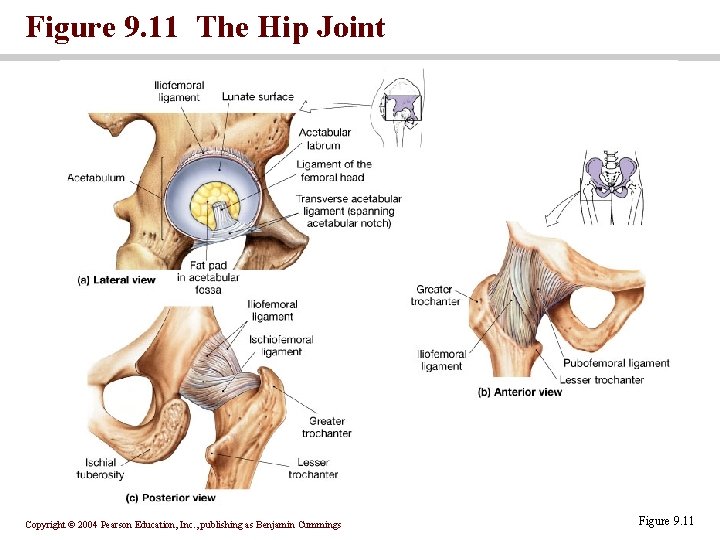 Figure 9. 11 The Hip Joint Copyright © 2004 Pearson Education, Inc. , publishing
