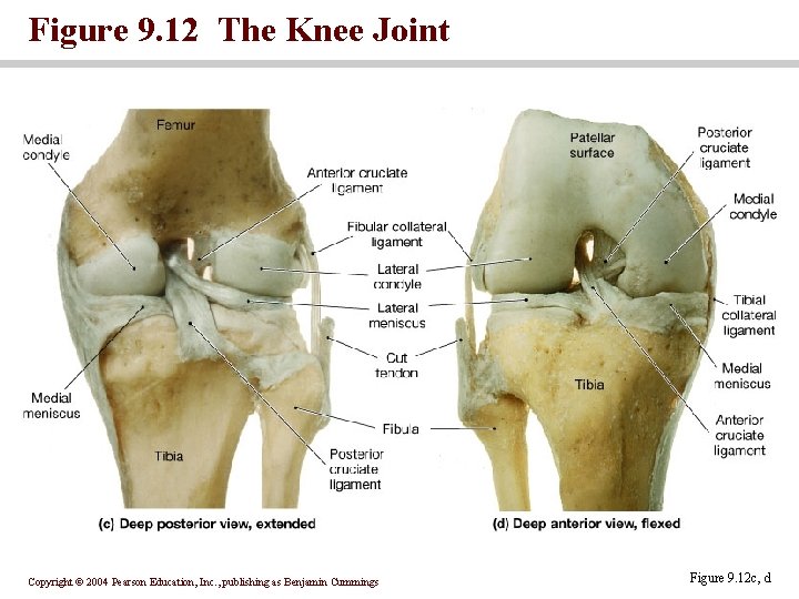 Figure 9. 12 The Knee Joint Copyright © 2004 Pearson Education, Inc. , publishing