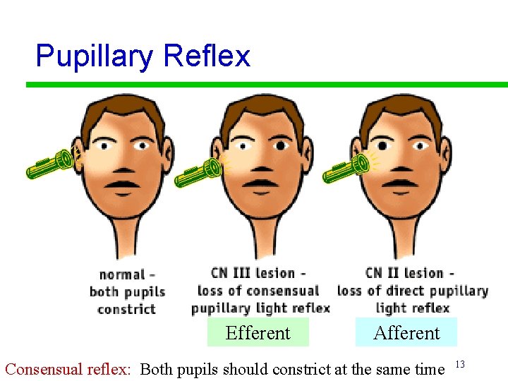 Pupillary Reflex Efferent Afferent Consensual reflex: Both pupils should constrict at the same time