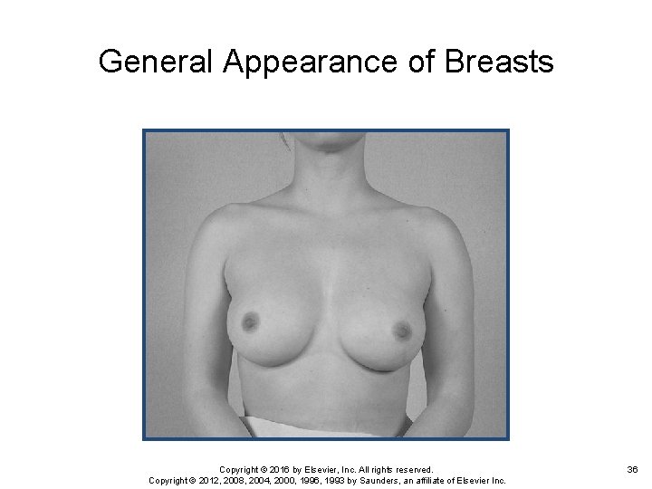 General Appearance of Breasts Copyright © 2016 by Elsevier, Inc. All rights reserved. Copyright